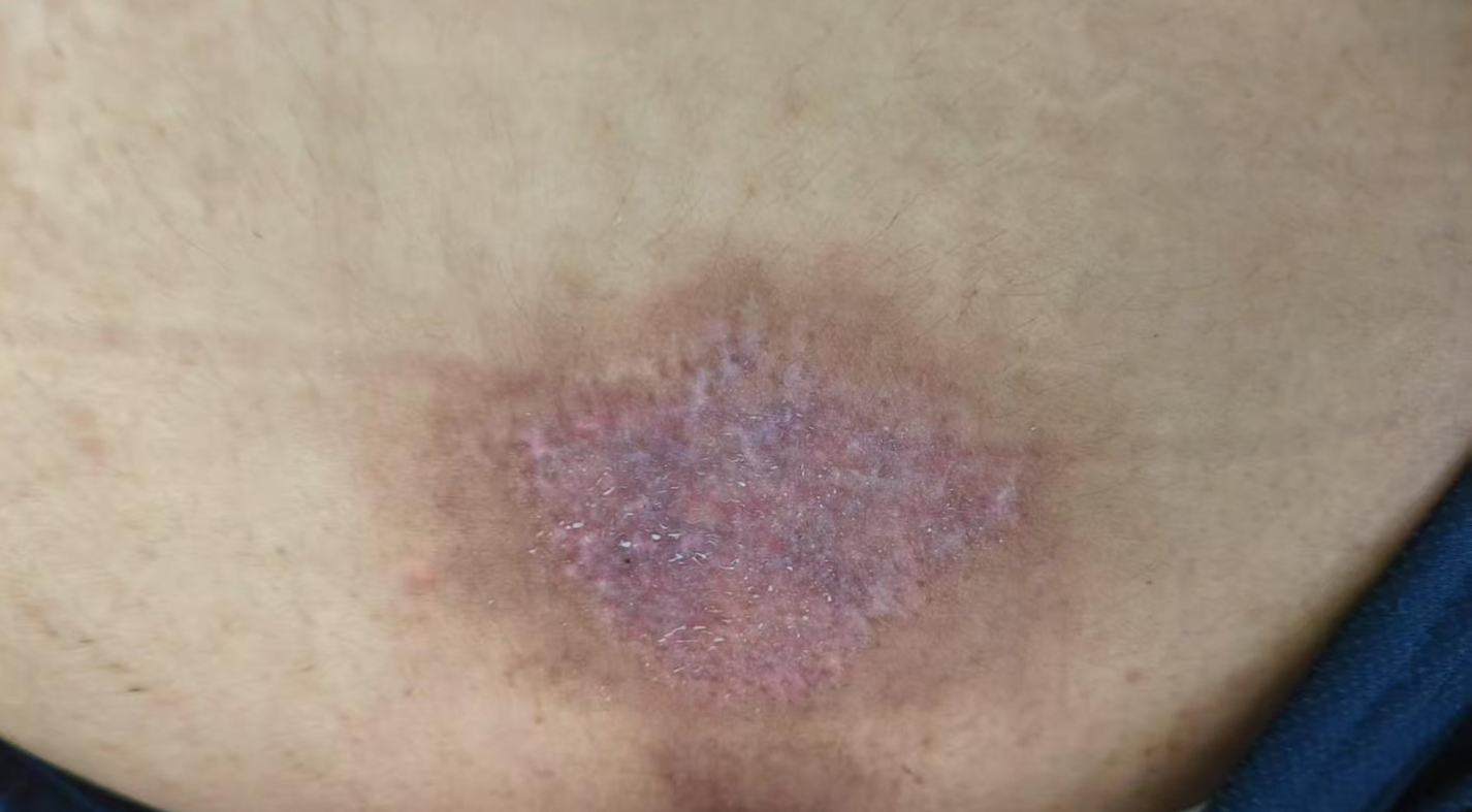 14岁女孩在拓展营遭体罚去世 班主任因截留信件受审(图2)